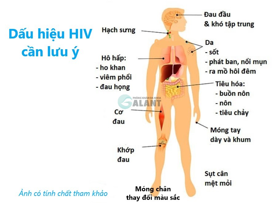 17 dau hieu hiv 1