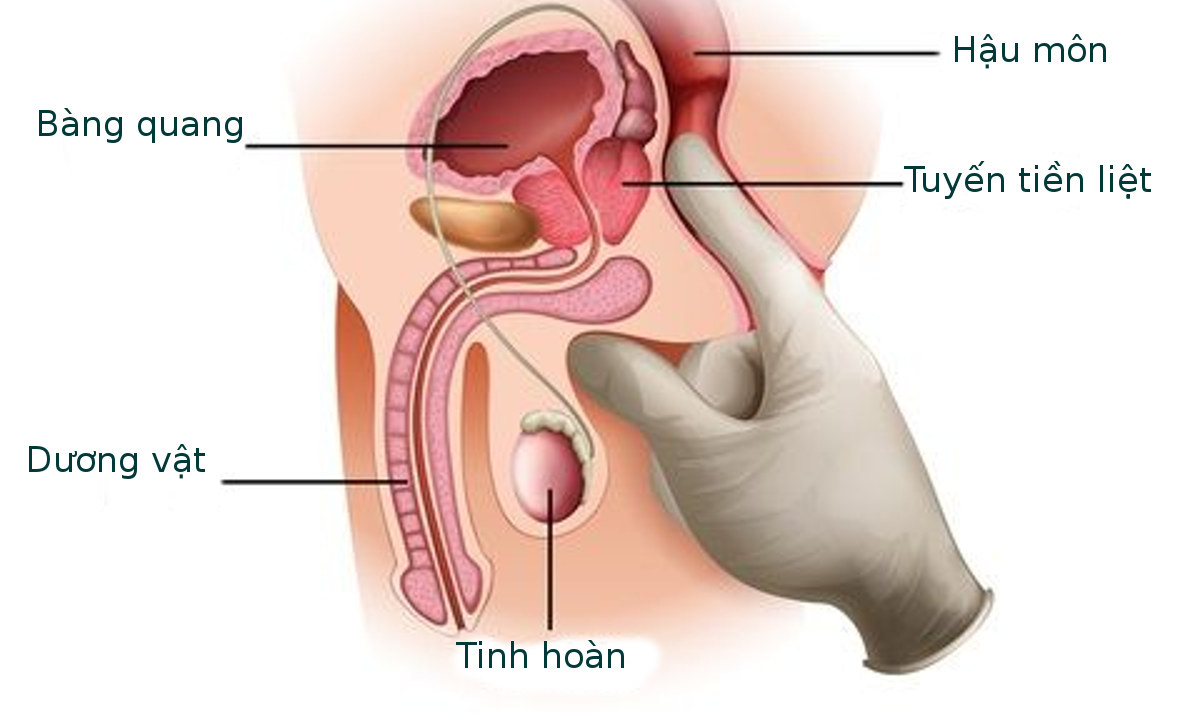 Tuyến tiền liệt