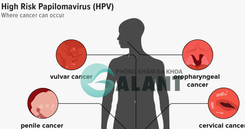 Vậy virus HPV lây nhiễm như thế nào?