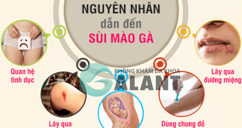 Những con đường lan bệnh sùi mào gà hiện nay