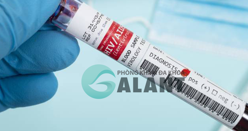 Xét nghiệm HIV bằng AB test nhanh có chính xác không