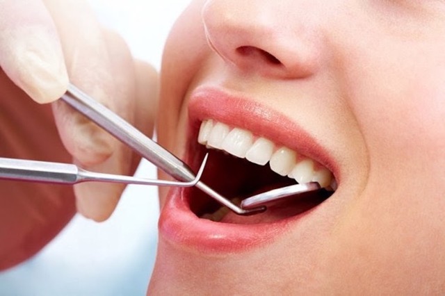 Bạn đã biết những điều cơ bản về cạo vôi răng hiện nay?