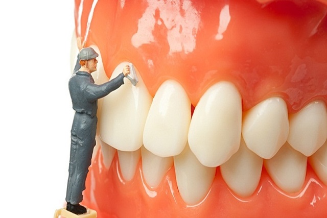 Các phương pháp lấy cao răng hiệu quả nhất hiện nay