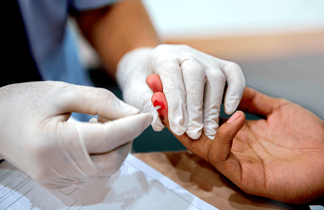 Các xét nghiệm HIV cần thiết và thời gian thực hiện