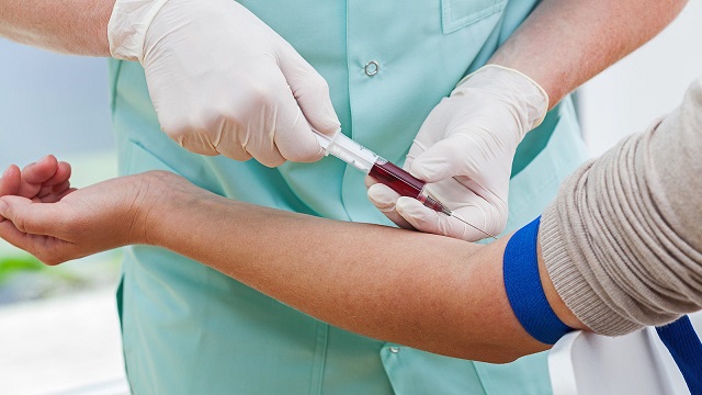 Cần lưu ý những gì trước khi xét nghiệm máu tổng quát?