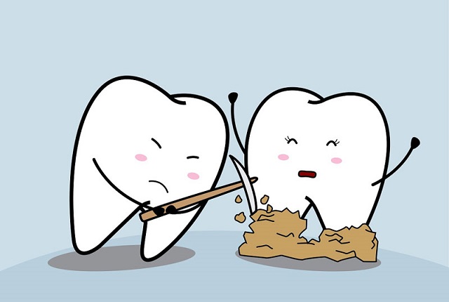 Cao răng là các mảng có màu trắng ngà bám dính trên bề mặt răng