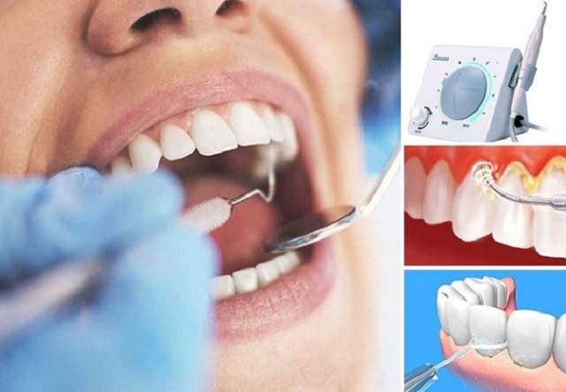 Cạo vôi răng có ảnh hưởng gì không?