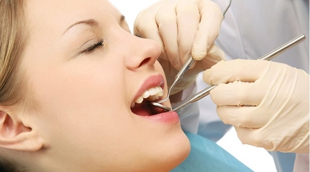 Cạo vôi răng có ảnh hưởng tới sức khỏe không?
