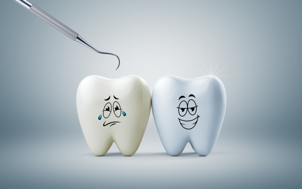 Chi phí bọc răng sứ dao động khoảng 1 - 7 triệu đồng.