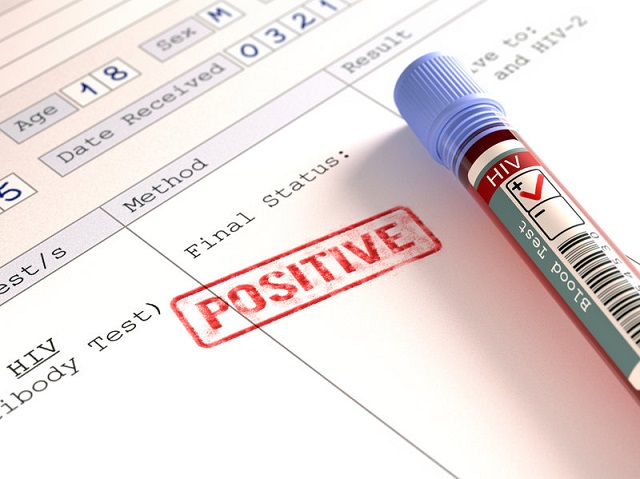 Cho kết quả nhanh chóng, mức chi phí không quá cao khi test nhanh HIV