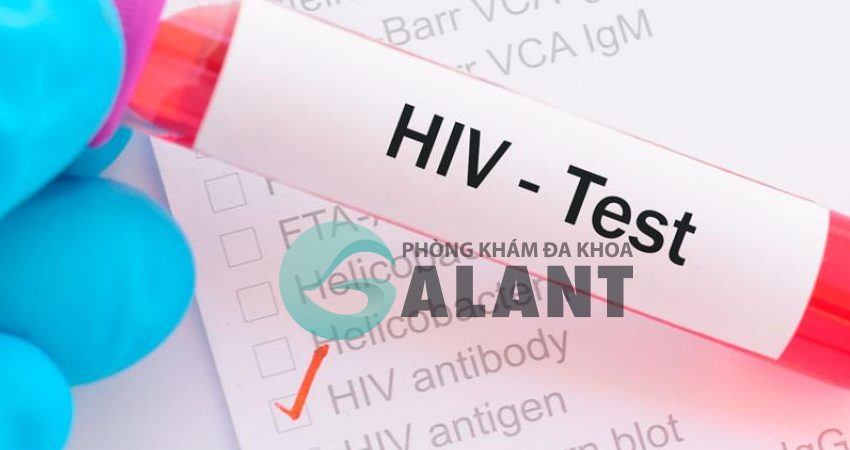 Có nên tự test virus HIV tại nhà không
