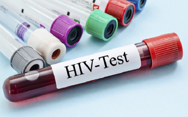 Đăng ký xét nghiệm HIV từ sớm, không phải chờ đợi lâu