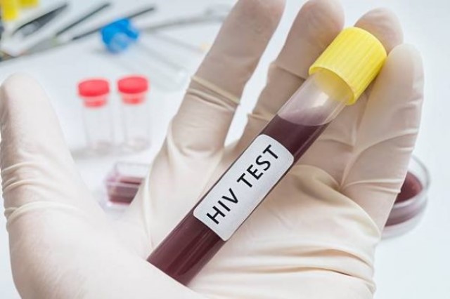 Để phát hiện bệnh, chúng ta nên đi xét nghiệm HIV.