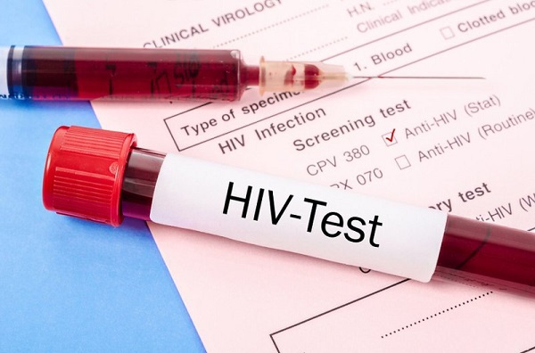 Giải đáp thắc mắc xét nghiệm HIV âm tính là gì?