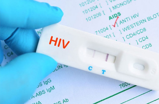 Giai đoạn trên 60 ngày sẽ là câu trả lời cho thời điểm xét nghiệm HIV lúc nào là chính xác