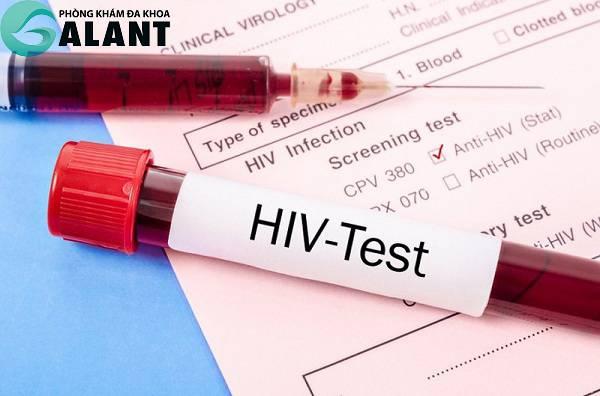 Xét nghiệm HIV để có phương án điều trị kịp thời