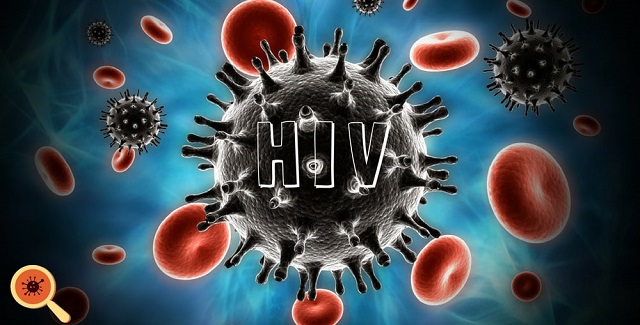 HIV là bệnh do nhiễm virus Human Immunodeficiency Virus gây nên