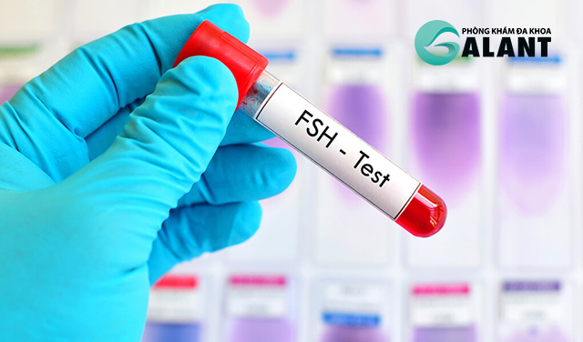 Khi đi xét nghiệm nội tiết nam, bạn sẽ được kiểm tra lượng FSH.