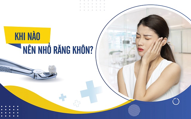 Khi nào nên nhổ răng khôn?