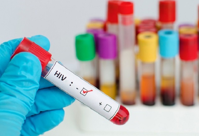 Không được dùng chung đồ với các đối tượng lây nhiễm HIV