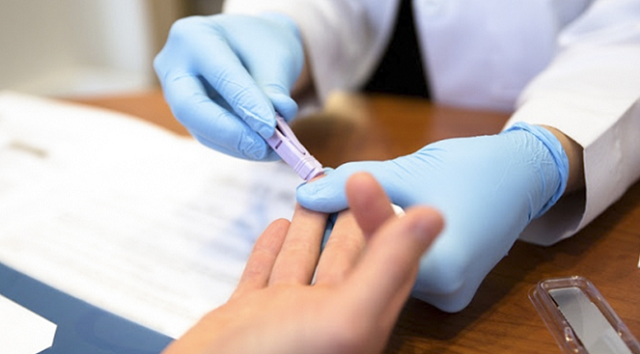 Lựa chọn dịch vụ xét nghiệm HIV đảm bảo uy tín, chính xác