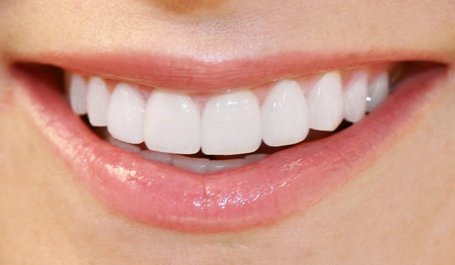 Lựa chọn nha khoa uy tín để tham gia dịch vụ tẩy trắng răng