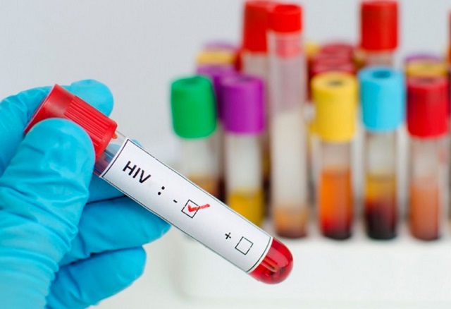 Mục đích của việc xét nghiệm HIV là tìm ra kháng thể chống lại virus HIV