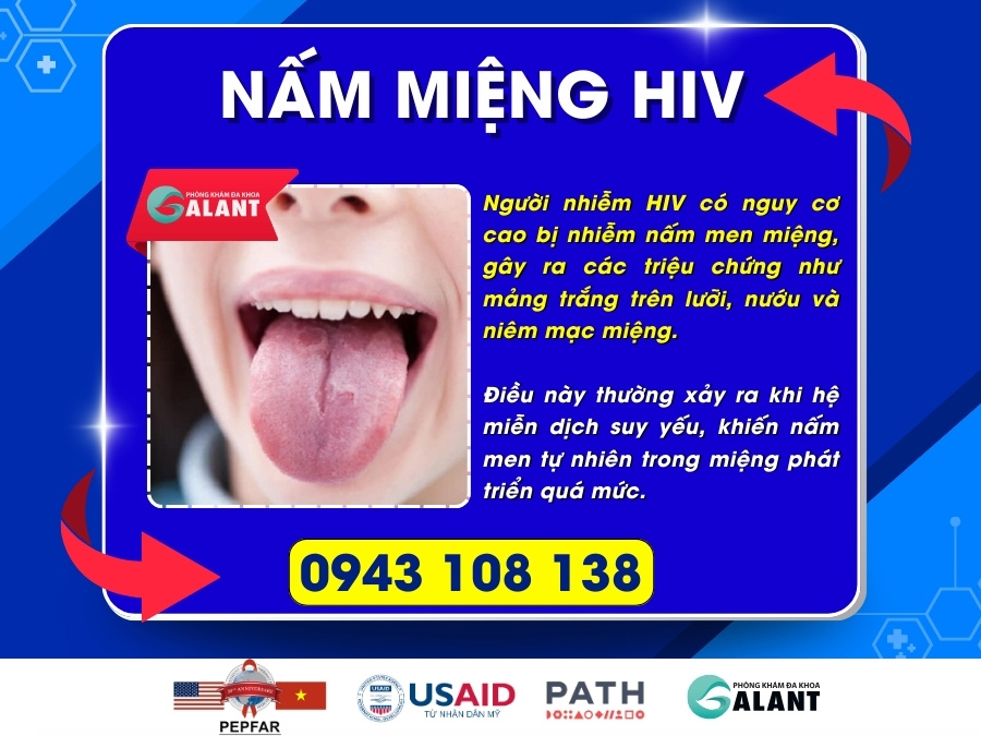 Nấm miệng HIV
