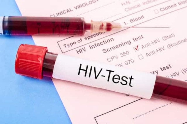 Nên xét nghiệm và thăm khám trước khi sử dụng thuốc ARV