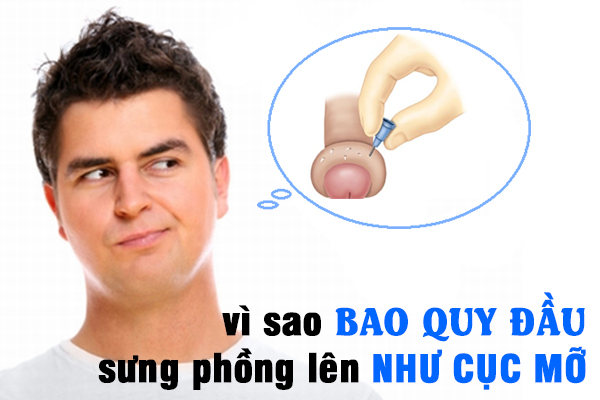 nguyen nhan bao quy dau sung mong nuoc