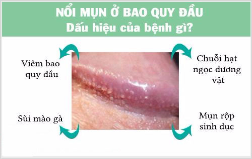 3. Các Bệnh Lý Liên Quan