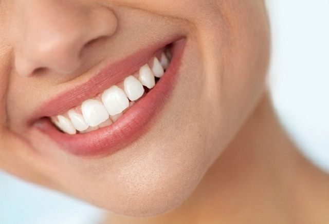 Phương pháp tẩy trắng cải thiện màu sắc sáng bóng trên răng