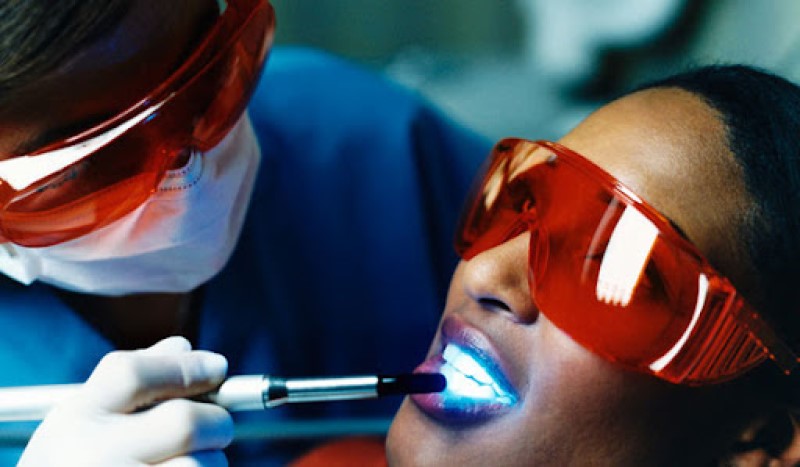 Phương pháp tẩy trắng răng bằng đèn plasma hiện đại và khá hiệu quả.