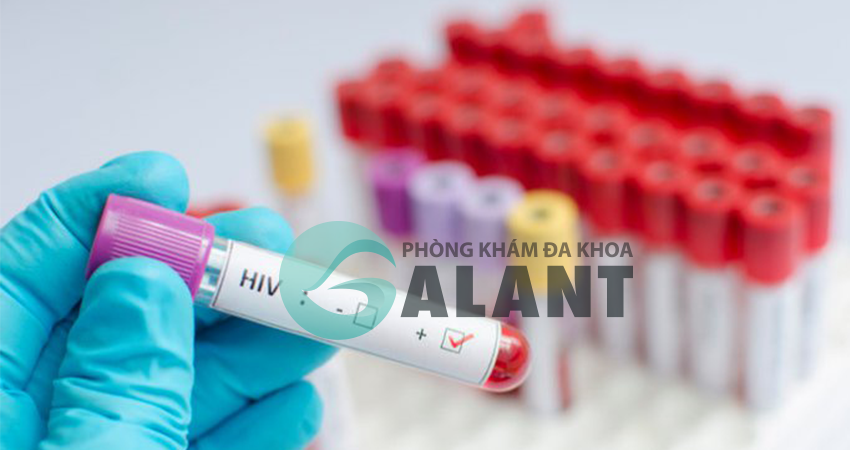 Quá trình xét nghiệm HIV AB test nhanh có chính xác không