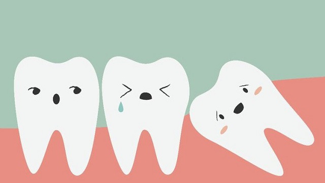 Răng hàm thứ ba của con người