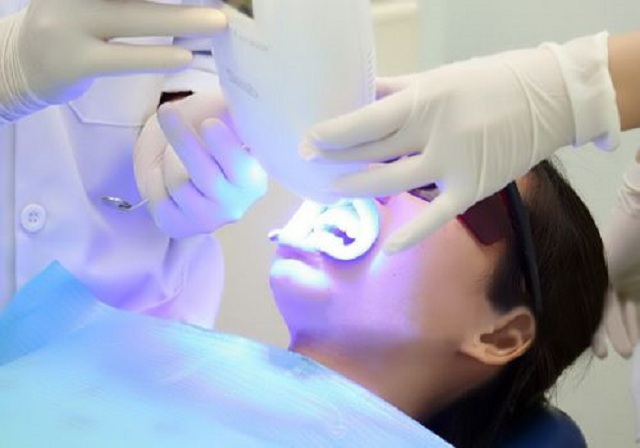 Tẩy răng ở nha khoa mang lại kết quả cao nhất