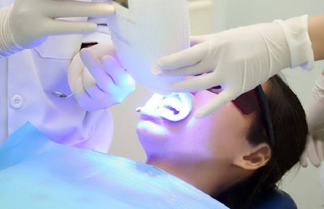 Tẩy trắng răng bằng công nghệ ánh sáng Laser Whitening