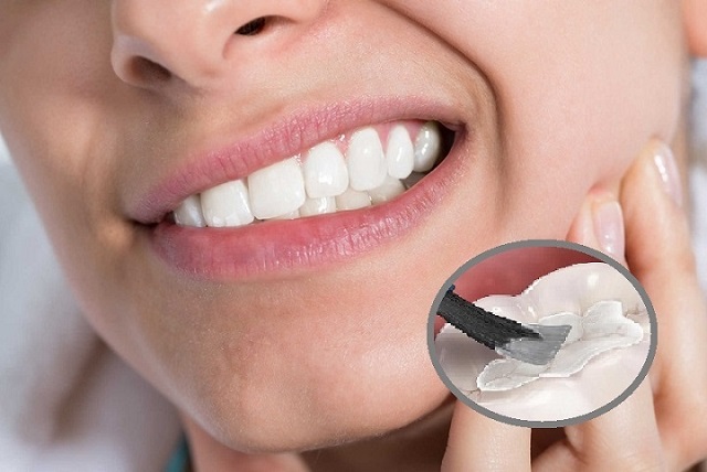 Trám răng giúp nâng cao thẩm mỹ và chức năng của răng