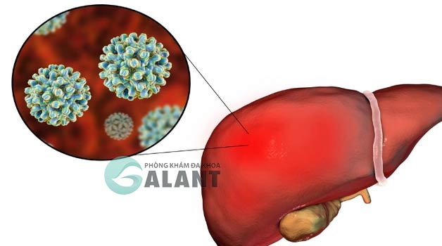 Viêm gan B nên uống nước gì?