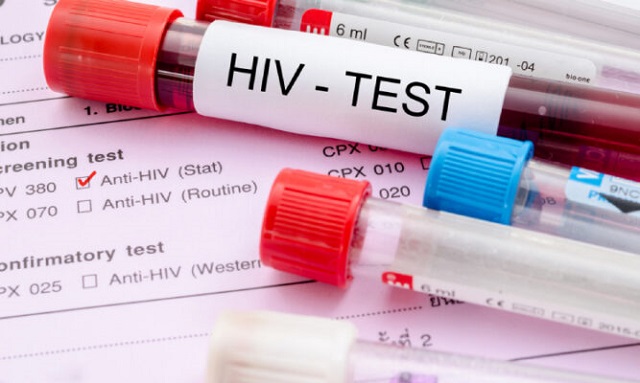 Xét nghiệm HIV giai đoạn cửa sổ