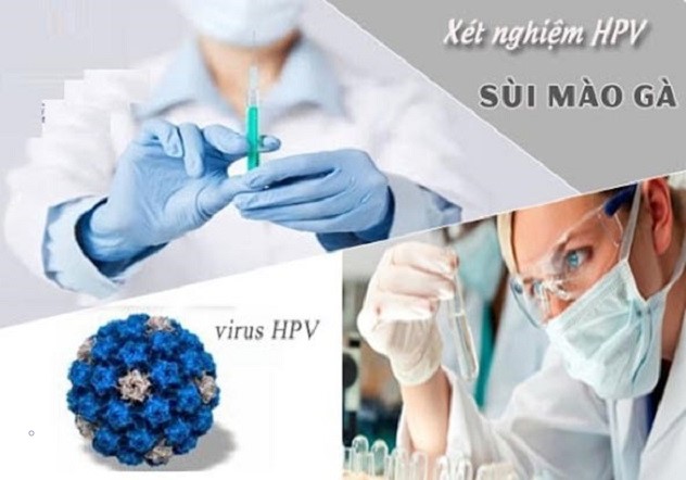 Xét nghiệm HPV để phát hiện và điều trị kịp thời