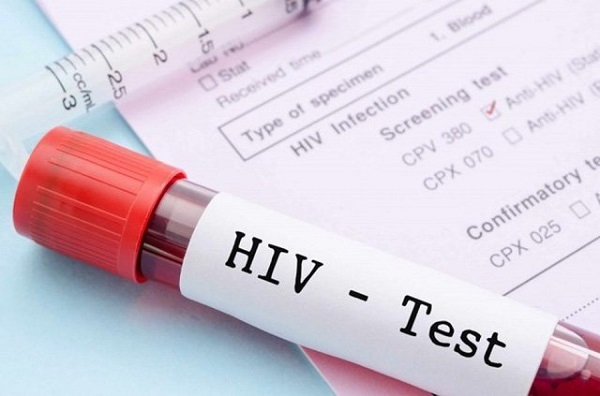 xét nghiệm PCR HIV
