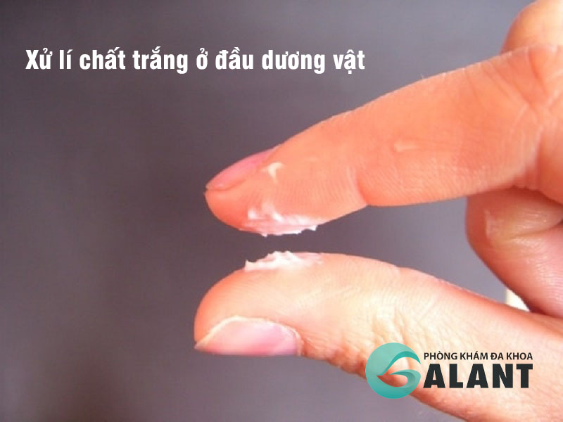 xu li chat trang o dau duong vat