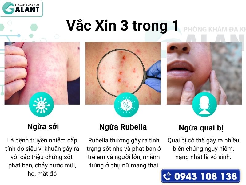 tiem ngua soi quai bi rubella vaccine 3 trong 1