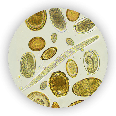Xét nghiệm 12 loại ký sinh trùng