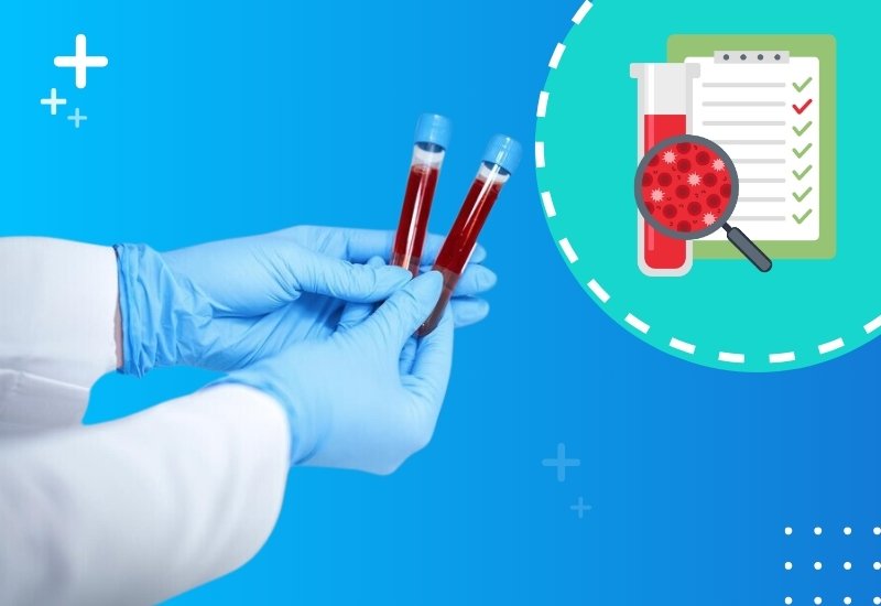 Xét nghiệm tổng phân tích tế bào máu ngoại vi - galant