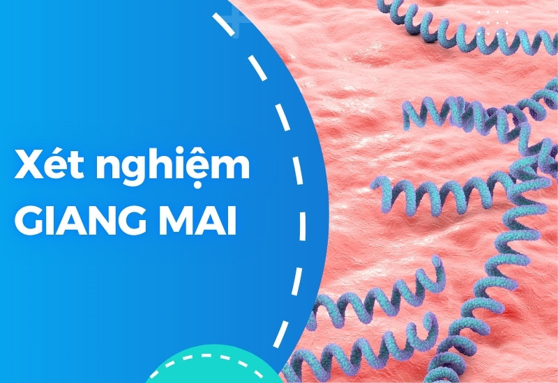 Xét nghiệm giang mai