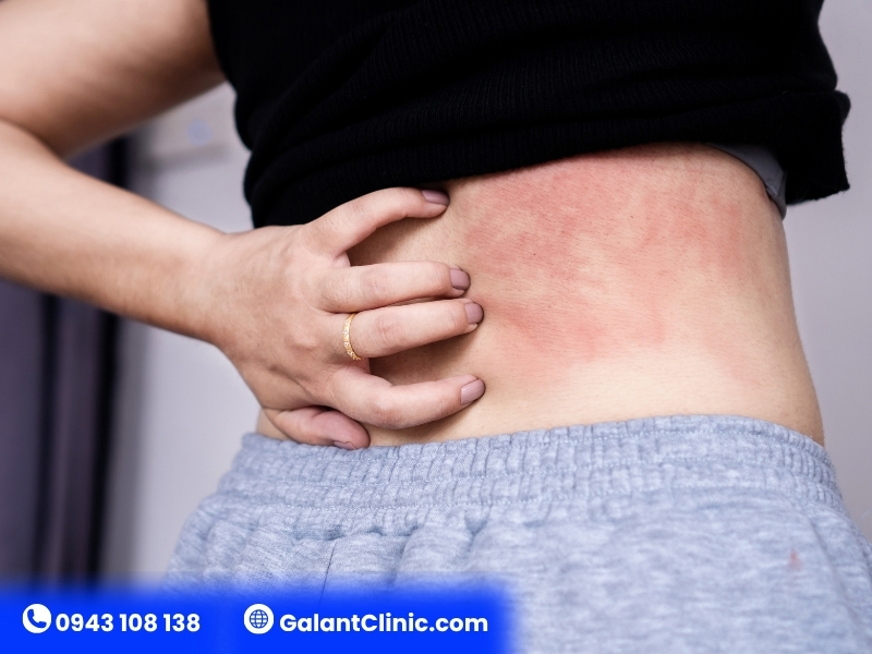 Dấu hiệu nhiễm HIV sau 10 năm