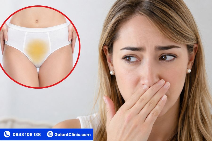 Hiện tượng âm đạo ra huyết trắng_ Ranh giới giữa sinh lý và bệnh lý